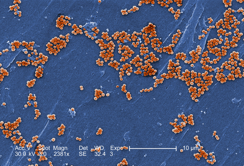 2005 Jeff Hageman, MHS This 2005 scanning electron micrograph (SEM) depicted numerous clumps of methicillin-resistant Staphylococcus aureus bacteria, commonly referred to by the acronym, MRSA; Magnified 2381x. Recently recognized outbreaks, or clusters of MRSA in community settings have been associated with strains that have some unique microbiologic and genetic properties, compared with the traditional hospital-based MRSA strains, which suggests some biologic properties, e.g., virulence factors like toxins, may allow the community strains to spread more easily, or cause more skin disease. A common strain named USA300-0114 has caused many such outbreaks in the United States. See PHIL 7823 for a black and white version of this micrograph. Staphylococcus aureus bacteria are found on the skin of all individuals. However, MRSA is a strain of these bacteria that has become resistant to certain antibiotics. These antibiotics include methicillin and other more common antibiotics such as oxacillin, penicillin and amoxicillin. Staph infections, including MRSA, occur most frequently among persons in hospitals and healthcare facilities (such as nursing homes and dialysis centers) who have weakened immune systems, however, the manifestation of MRSA infections that are acquired by otherwise healthy individuals, who have not been recently hospitalized, or had a medical procedure such as dialysis, or surgery, first began to emerged in the mid- to late-1990's. These infections in the community are usually manifested as minor skin infections such as pimples and boils. Transmission of MRSA has been reported most frequently in certain populations, e.g., children, sports participants, or jail inmates.
